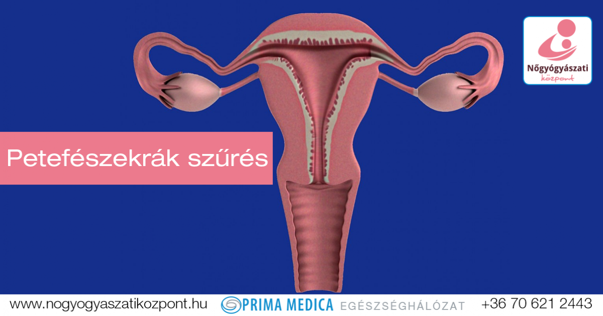 petefészekrák vs ciszta)