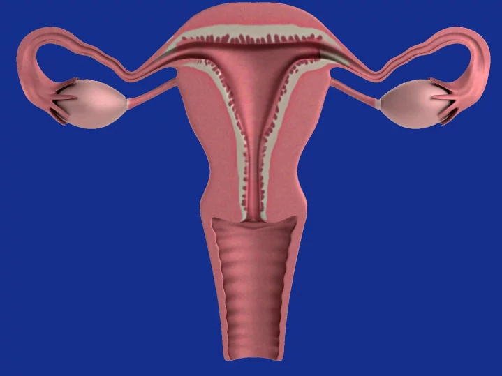 A menopauza utáni vérzés méhnyálkahártya hiperpláziát is jelezhet 